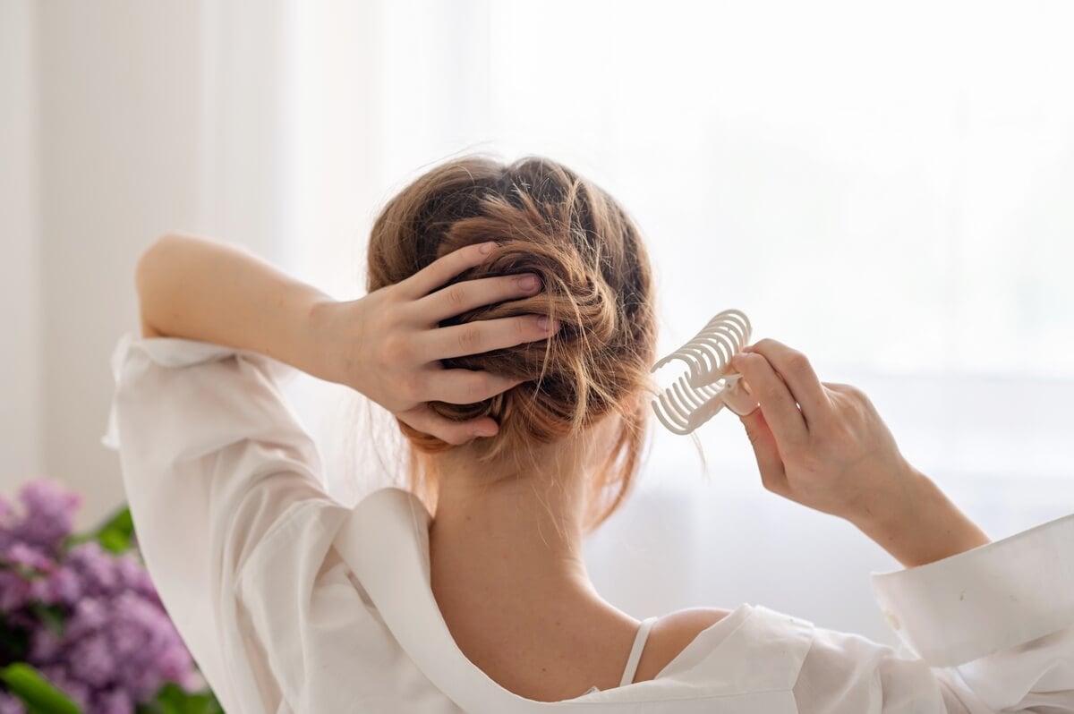 Hair Loss in Women with PCOS 