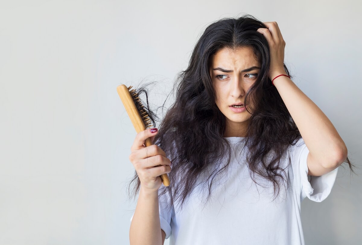 Hair Loss in Women with PCOS