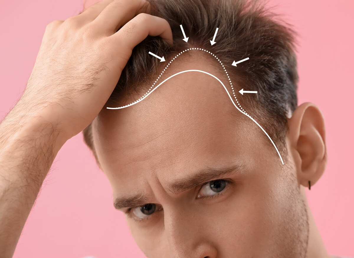 Myths and Facts About the Best Hair Growth Product