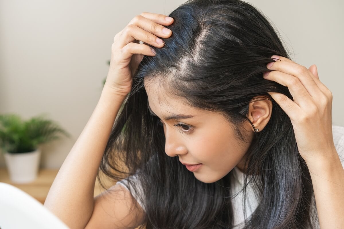 Hair Thinning At Temples Causes And Fixes