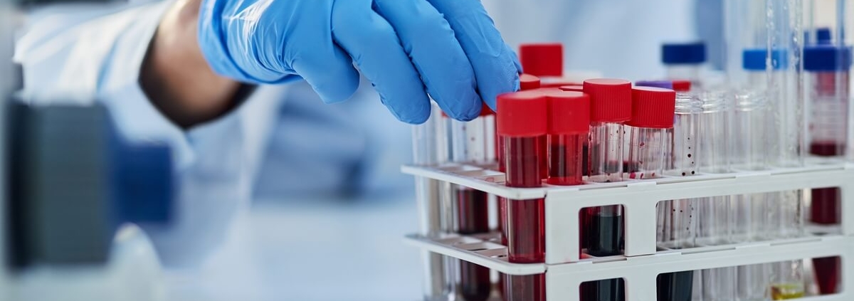 How to test testosterone levels accurately