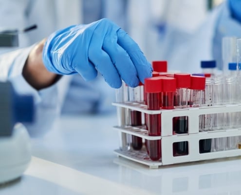 How to test testosterone levels accurately