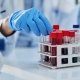 How to test testosterone levels accurately