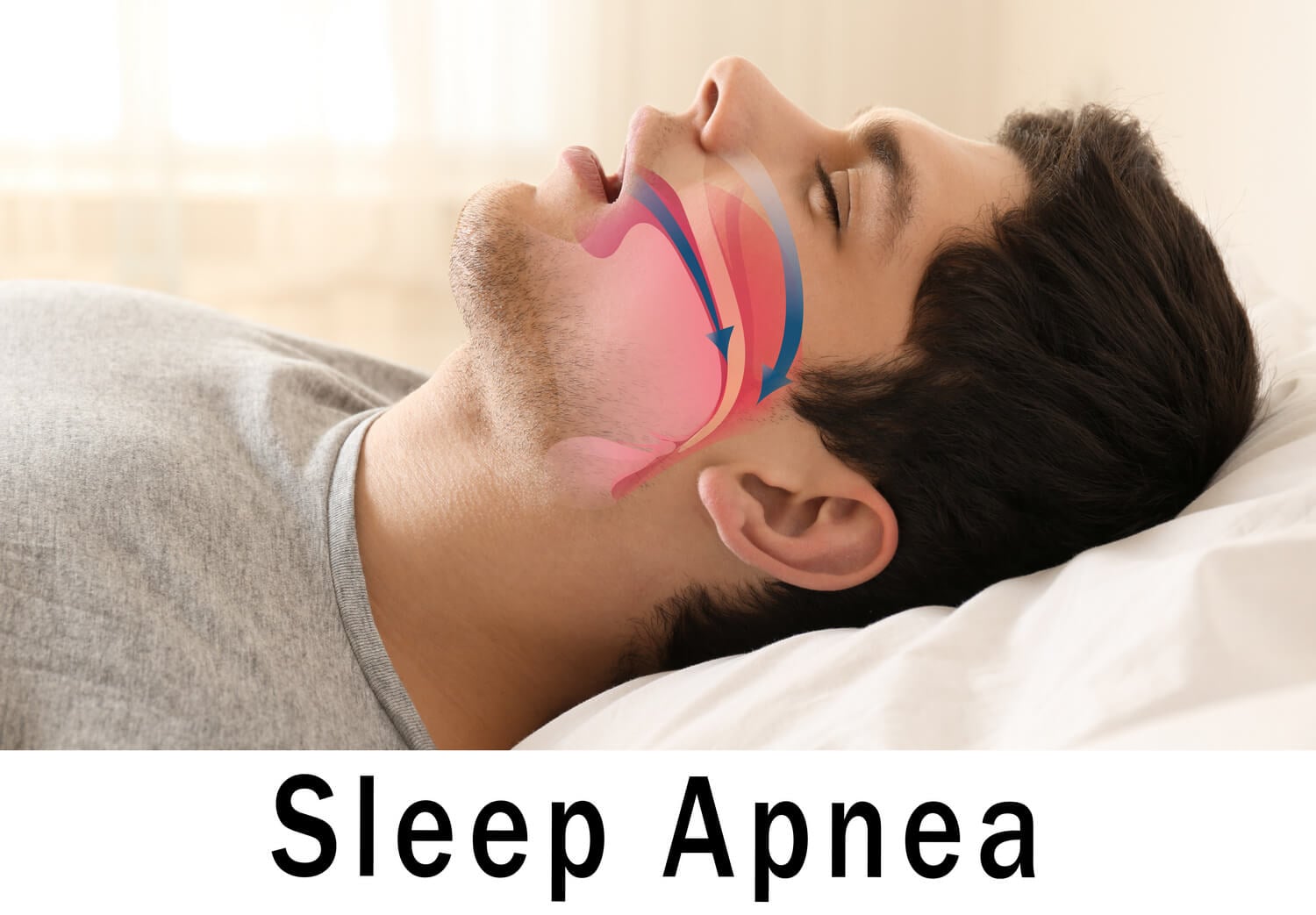 Can Low Testosterone Cause Insomnia